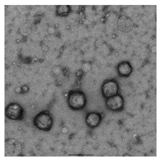 电子显微镜下白桦脂醇纳米乳的形态(x10000) 电子显微镜下白桦脂醇纳米乳的形态(x10000)