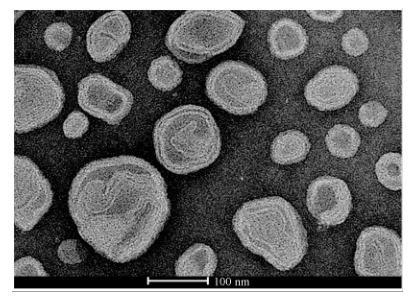 脂质体透射电镜(TEM)检测结果(x100000) 脂质体透射电镜(TEM)检测结果(x100000)