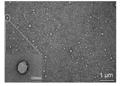 多重修饰血紫蛋白纳米粒的微观形貌 ( 透射电镜 )